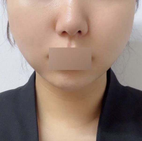 Nâng cơ bằng chỉ là một quyết định tuyệt vời