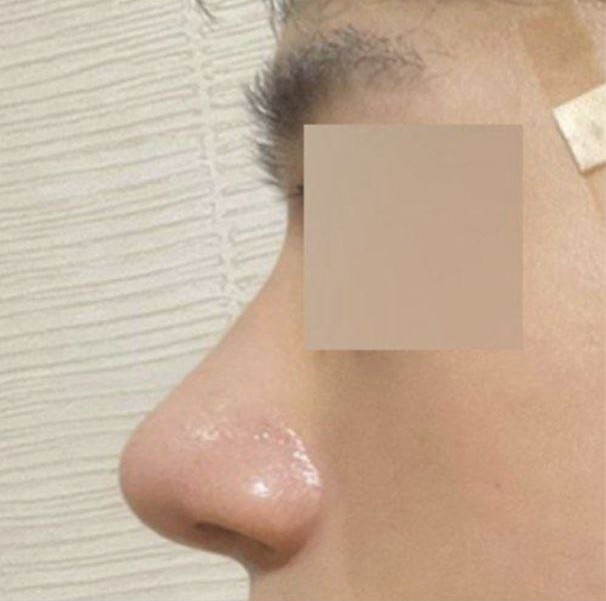 Họ đã xem xét rất chi tiết và giải thích cho mình rất rõ ràng!