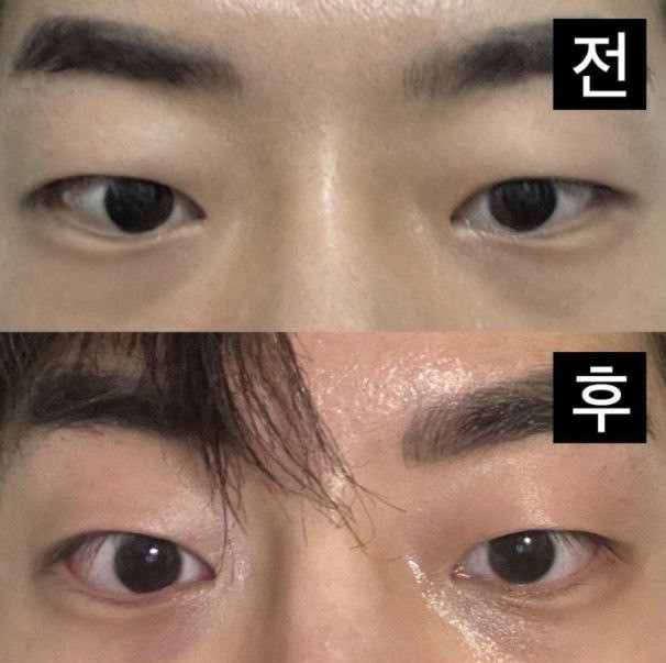 Không chỉ mắt mà mũi cũng thành công ngoài mong đợi