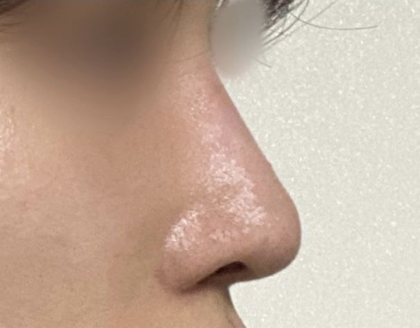 Mình rất vui vì có được chiếc mũi ưng ý!