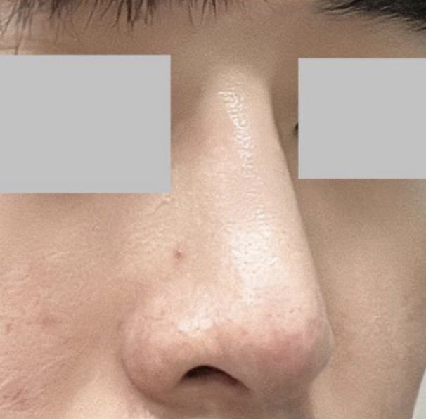 Mình muốn một vẻ ngoài tự nhiên và nó hoàn toàn phù hợp với mình