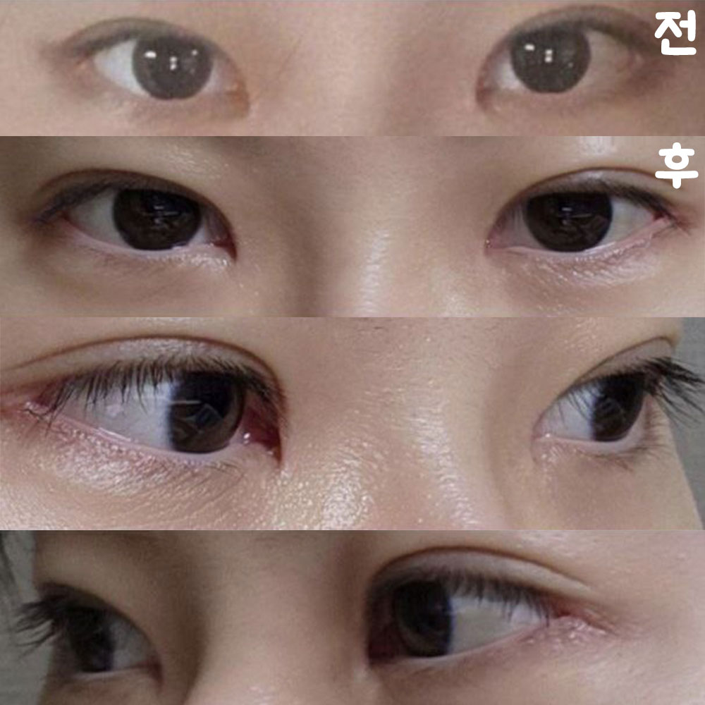 Mình rất hài lòng vì đôi mắt trông thoáng và dễ chịu hơn rất nhiều!