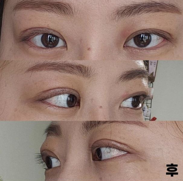 Mình nghĩ rằng mình đã làm rất tốt khi phẫu thuật