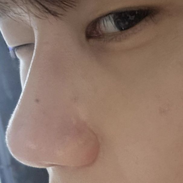 Mình nghĩ rằng mình đã làm tốt khi phẫu thuật. Cảm ơn bạn.