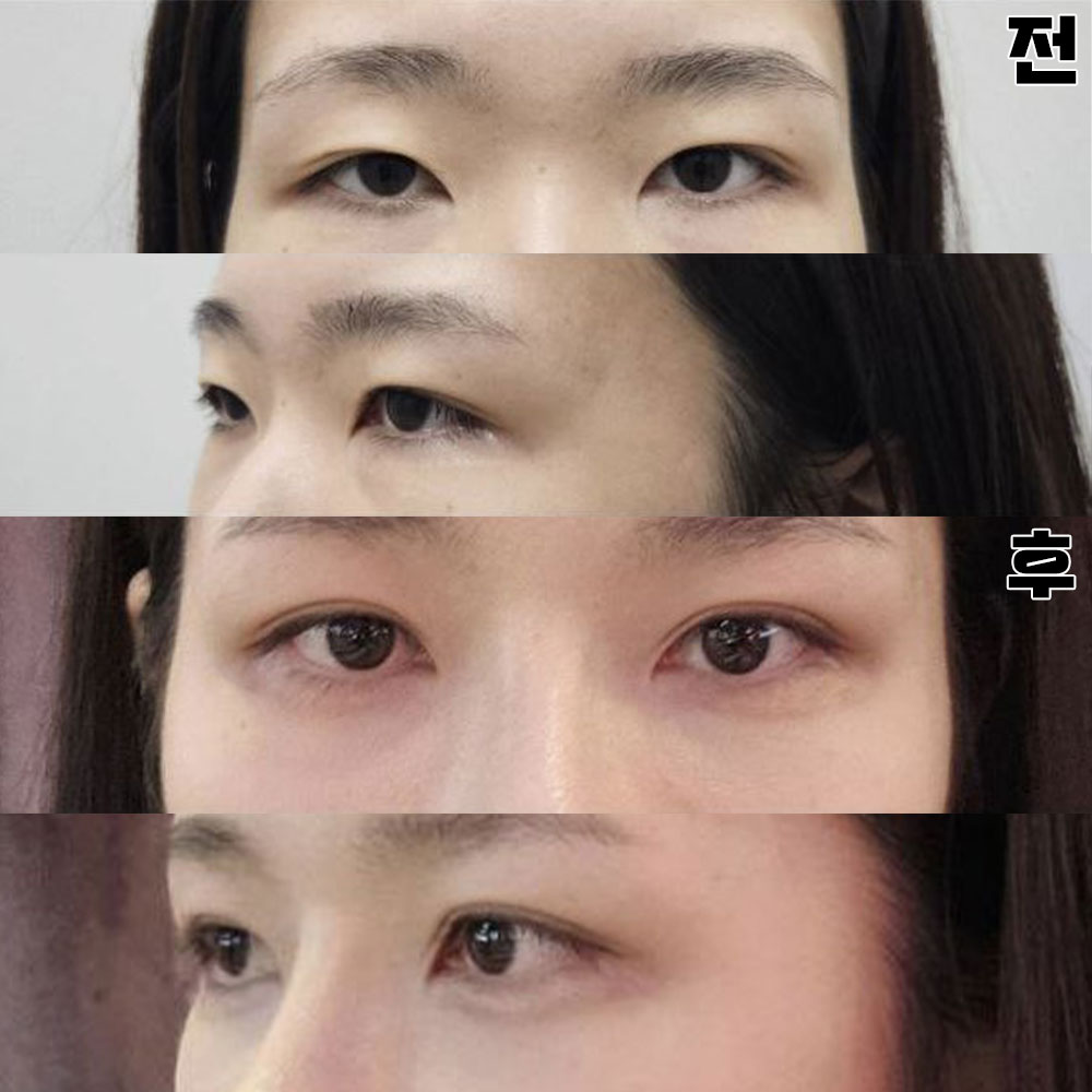 Lấy đường nét thật mỏng và tự nhiên rất tốt