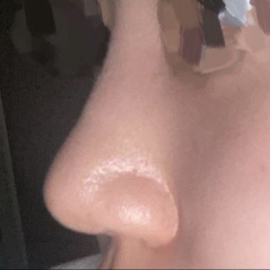 Tuyệt vời quá ㅠㅠㅠ Cảm ơn bác sĩ..