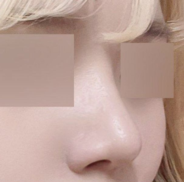 Mình sẽ không làm nếu không có niềm tin vào bác sĩ ㅋㅋ