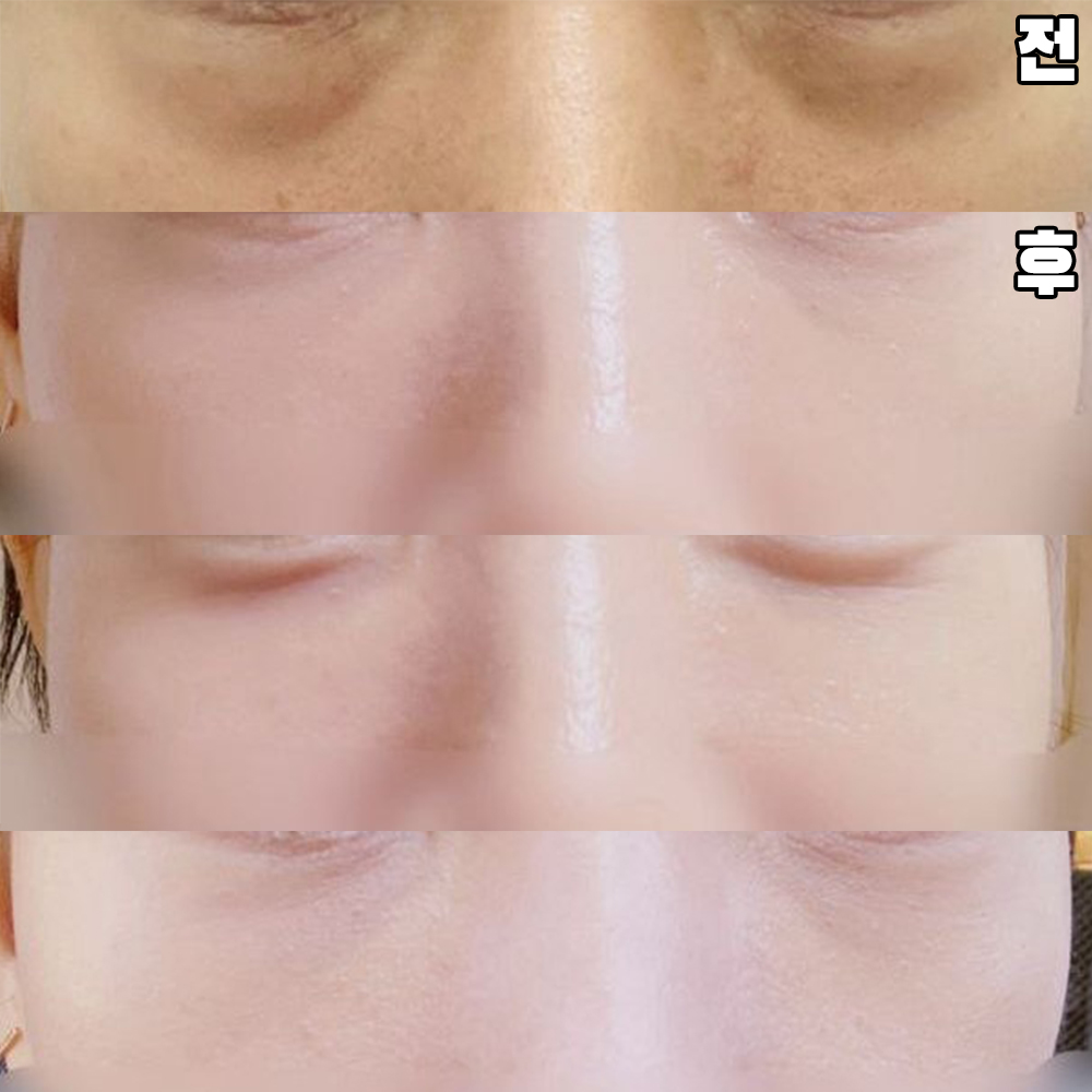 Mình hy vọng nó sẽ tốt hơn theo thời gian.