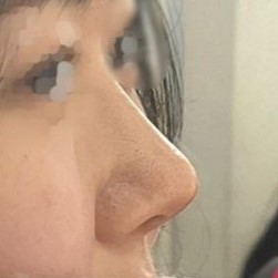 Bây giờ mình rất hài lòng nên lúc nào soi gương cũng phải trầm trồ...