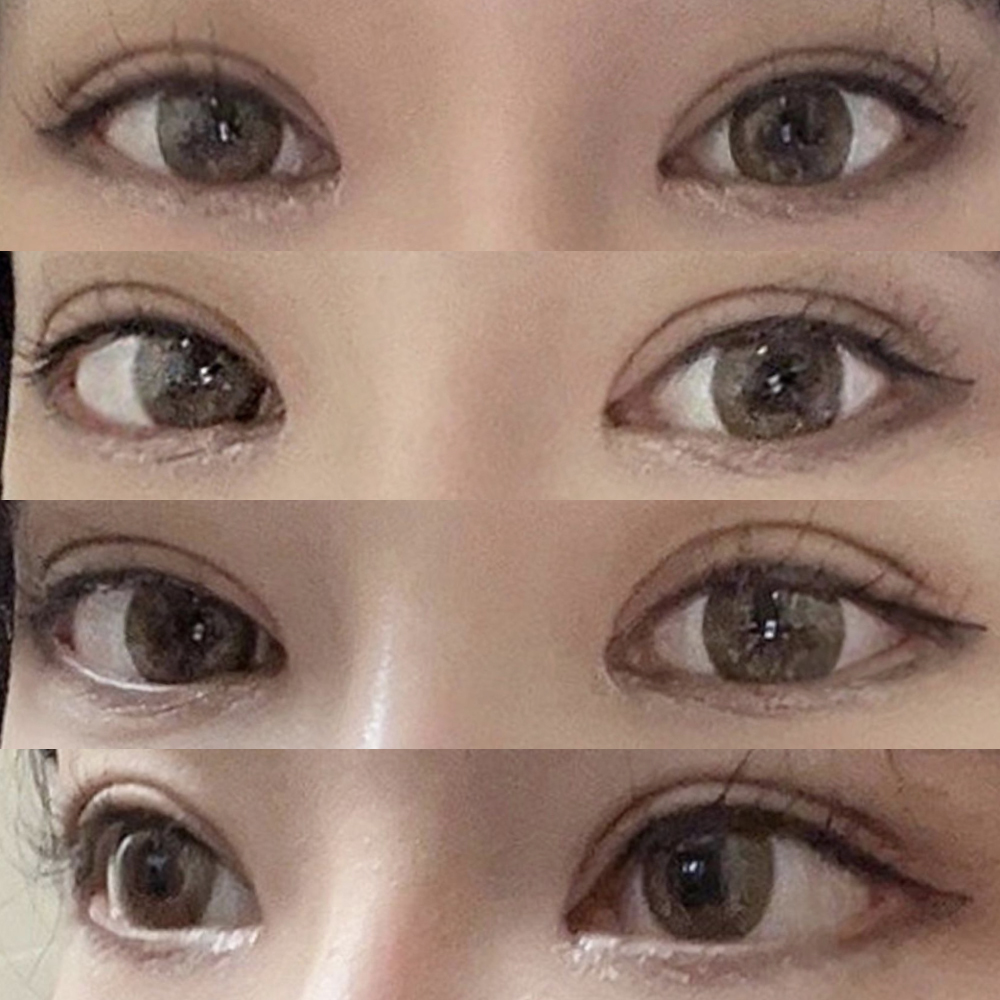 Mình đã sửa mắt một mí!