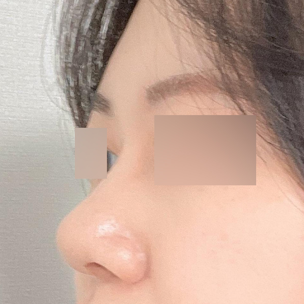 Đánh giá sau 3 tháng phẫu thuật