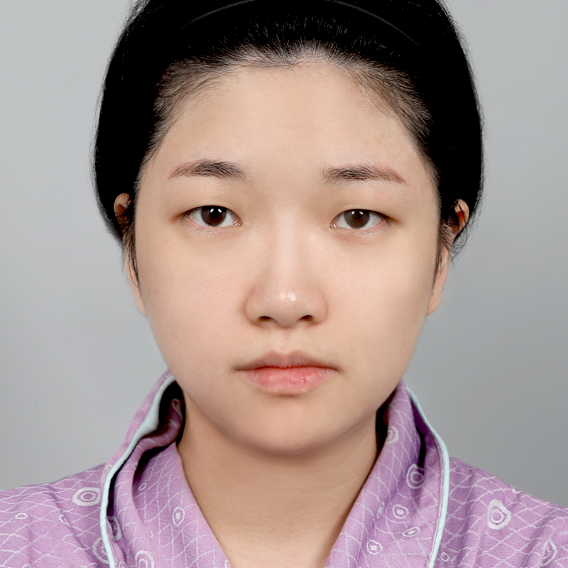 #Sốngmũi(silicone) #Đầumũi(sụn tự thân) #Rạch một phần #Chỉnhhìnhmắt #Loạibỏbọngmỡtrên